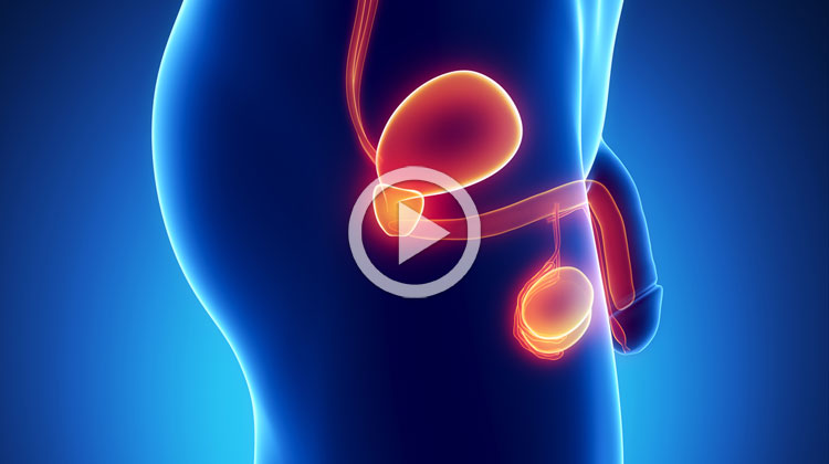 Nezhubné zväčšenie prostaty, zápal prostaty a účinky magnetoterapie
